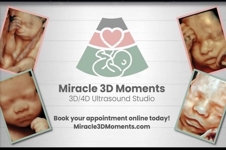 Miracle 3D Moments