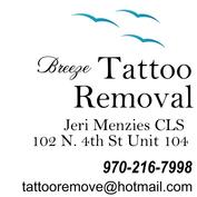 Breeze Tattoo Removal